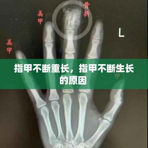 指甲不断重长，指甲不断生长的原因 