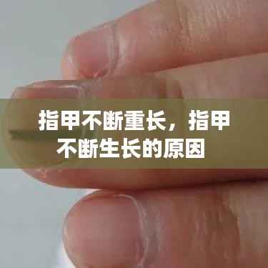 指甲不断重长,指甲不断生长的原因